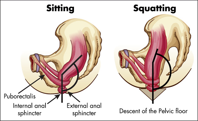 Anal Rectal Angle - Sitting Vs Squatting